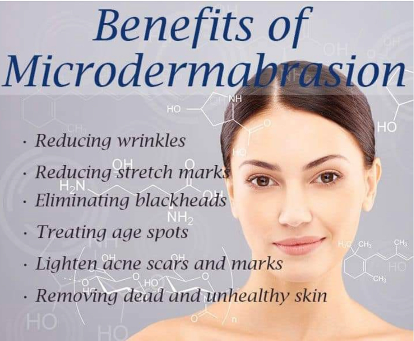 Benefits of Microdermabrasion